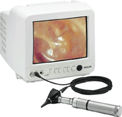 video otoscope