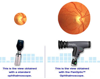 welch allyn panoptic ophthalmoscope comparison view